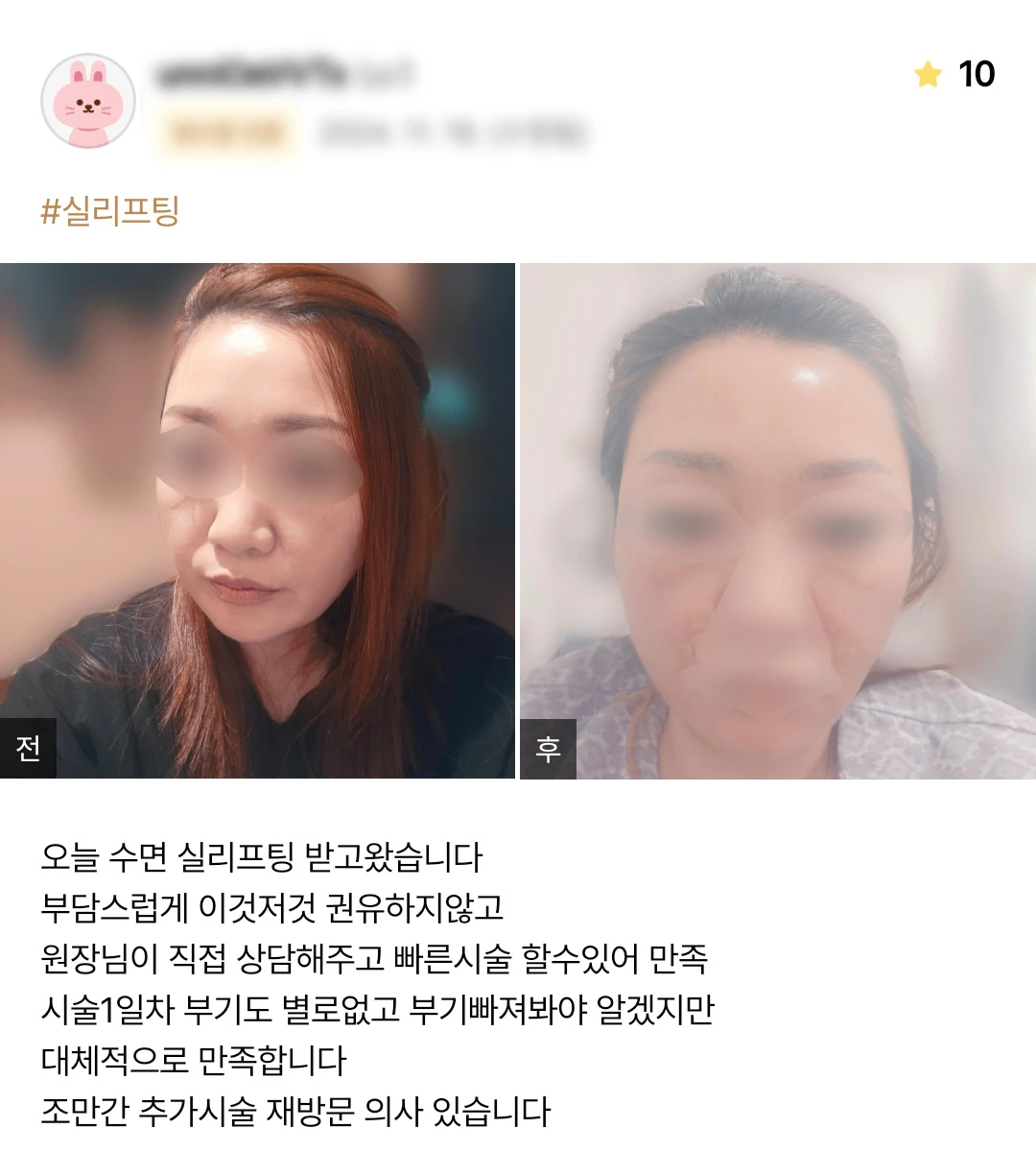 Thread lifting patient photo review — 202 at Merry Plastic Surgery Clinic. Thread lifting at Merry Plastic Surgery: before-and-after photographs shown in the supplied patient review. The source labels the follow-up as Treatment day.