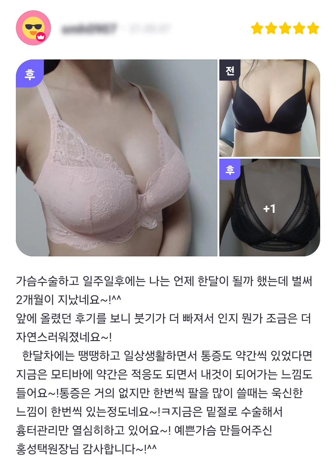Breast augmentation patient photo review — 297 at Merry Plastic Surgery Clinic. Breast augmentation at Merry Plastic Surgery: before-and-after photographs shown in the supplied patient review. The source labels the follow-up as 2 months.