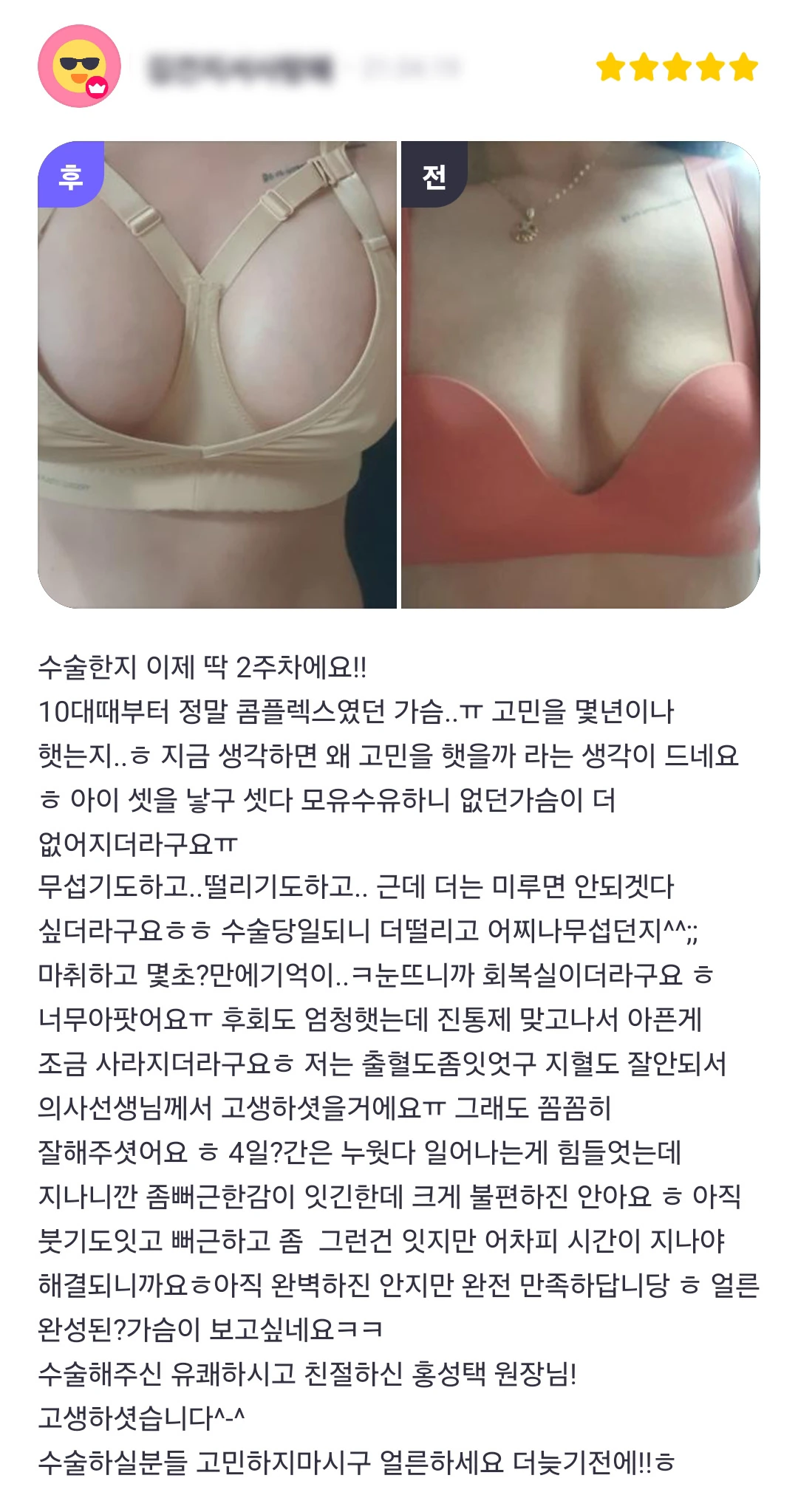 Breast augmentation patient photo review — 302 at Merry Plastic Surgery Clinic. Breast augmentation at Merry Plastic Surgery: before-and-after photographs shown in the supplied patient review. The source labels the follow-up as 2 weeks.