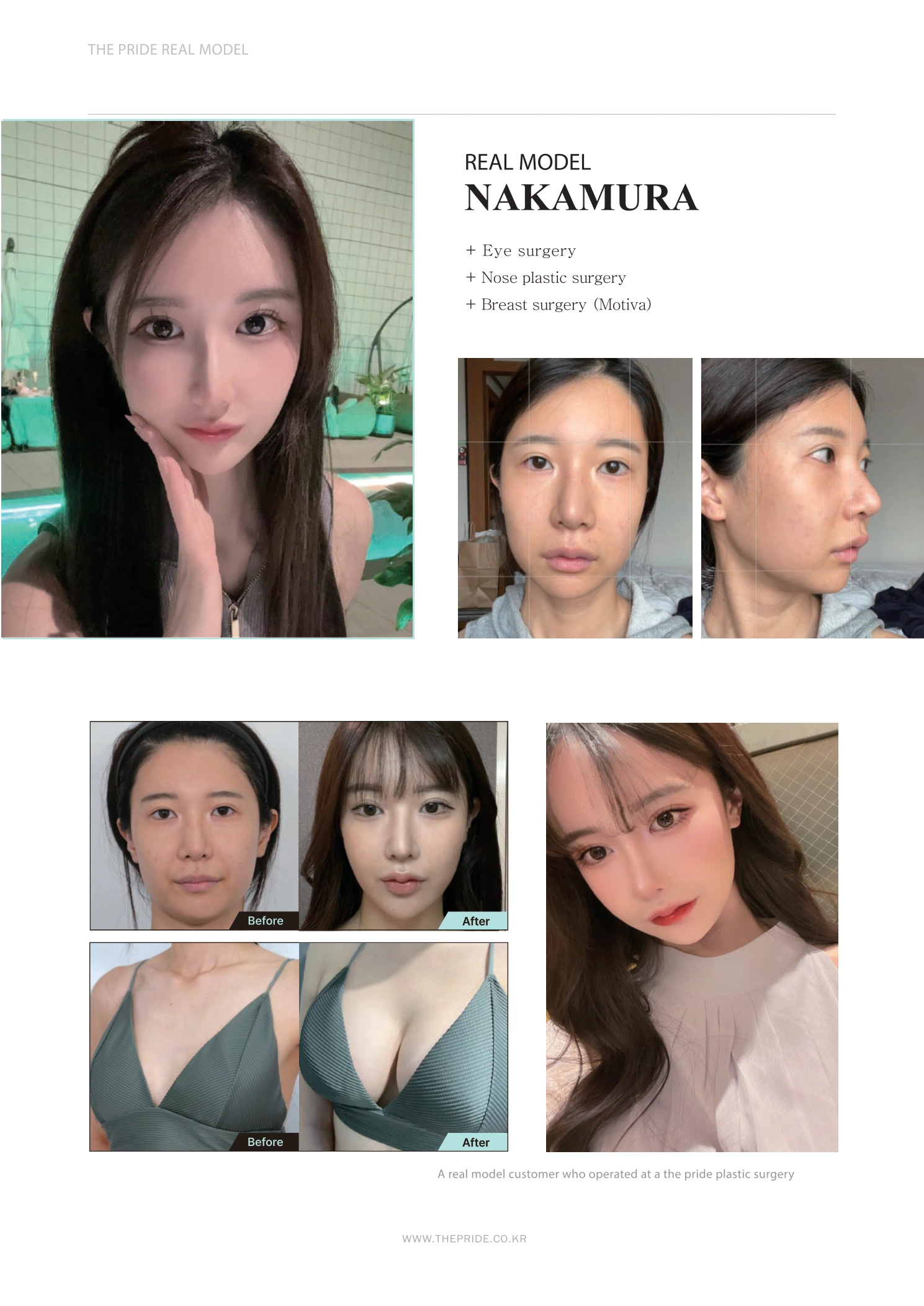 Eye, nose and breast surgery — photo story at The Pride Plastic Surgery. The Pride Plastic Surgery, Seoul: eye, nose and breast surgery — photo story, reproduced from page 18 of the clinic-supplied booklet. Before-and-after labels and photographed views remain as supplied.